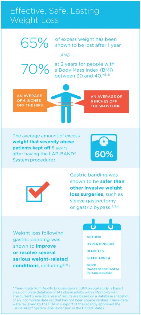 Lap-Band Statistics Infographic