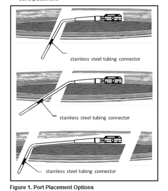 Port Placement Options